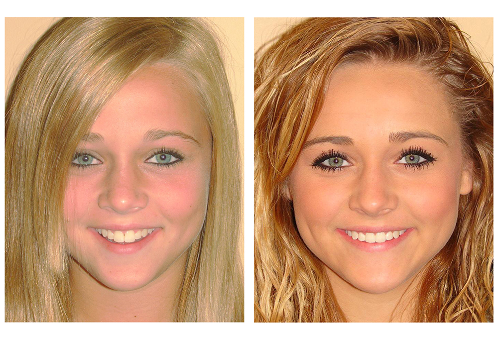 Bailey Dental Willis