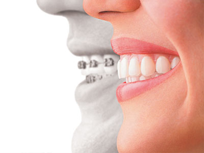 The image features a split-screen comparison between a person's natural teeth and an alternative, likely dental implants or veneers, with a focus on oral health and cosmetic dentistry.