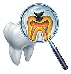 Alt text: An illustration showing an open human mouth with teeth and gums, viewed through a magnifying glass, revealing the internal structure of a tooth with roots and pulp, and a dental implant in place of a missing tooth, set against a white background.
