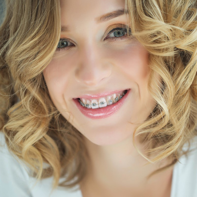 The image shows a person smiling at the camera with braces, wearing a white top and a light-colored blouse with curly hair.