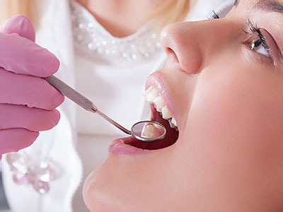 A dental professional performing a dental procedure on a patient's mouth.