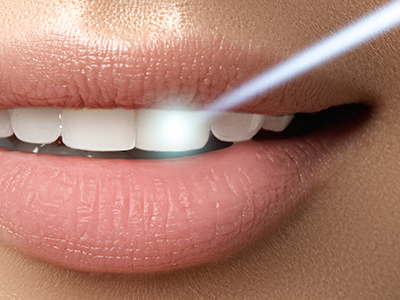 The image features a close-up of a person's lips with a focus on their teeth, set against a blurred background, likely for promotional or product display purposes.